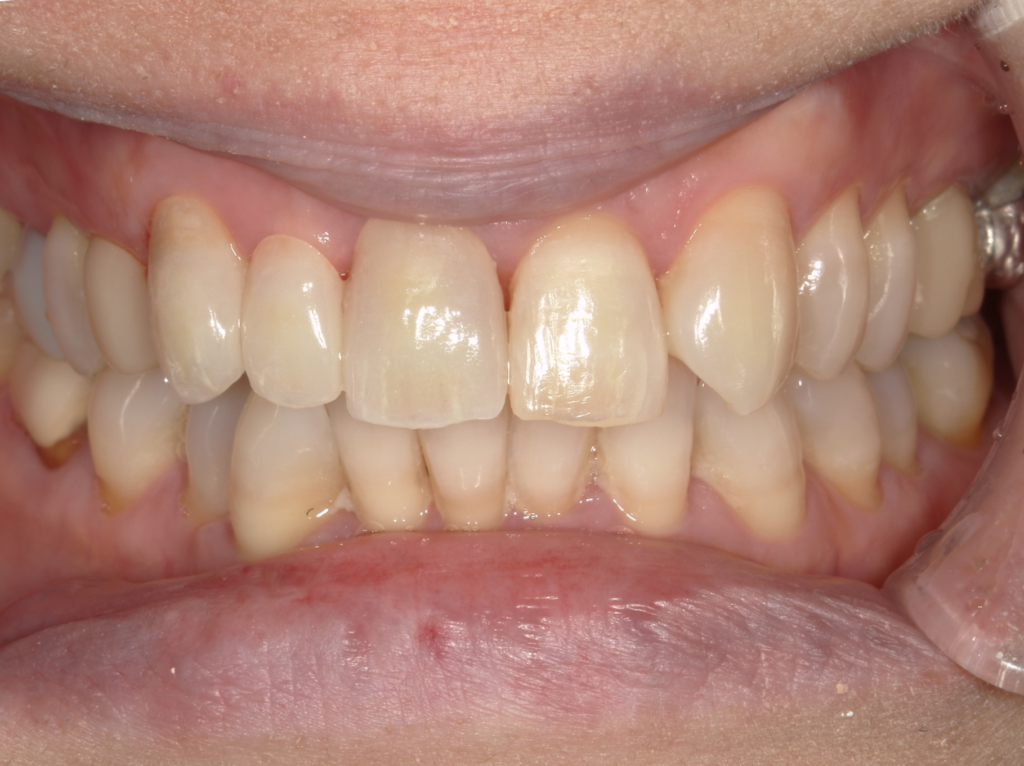 画像に alt 属性が指定されていません。ファイル名: saisyuu--1024x766.bmp