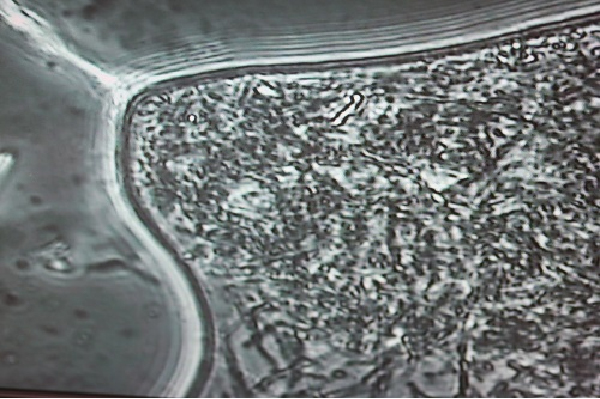 顕微鏡で見た歯周病菌